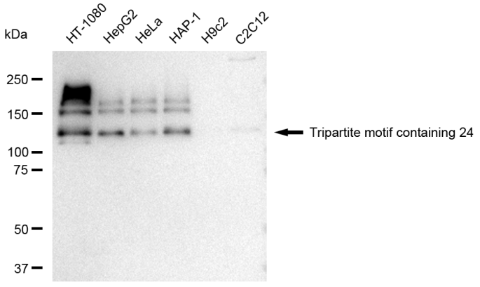 [KD Validated] Anti-TRIM24 Rabbit mAb [41S83E06]