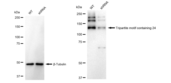 [KD Validated] Anti-TRIM24 Rabbit mAb [41S83E06]