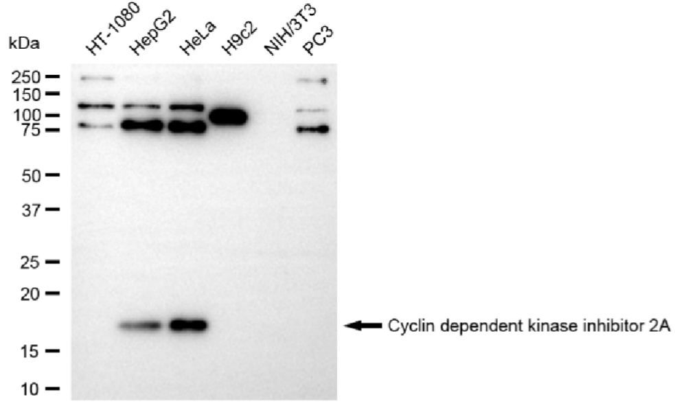 [KD Validated] Anti-CDKN2A Rabbit mAb [63N54O65]