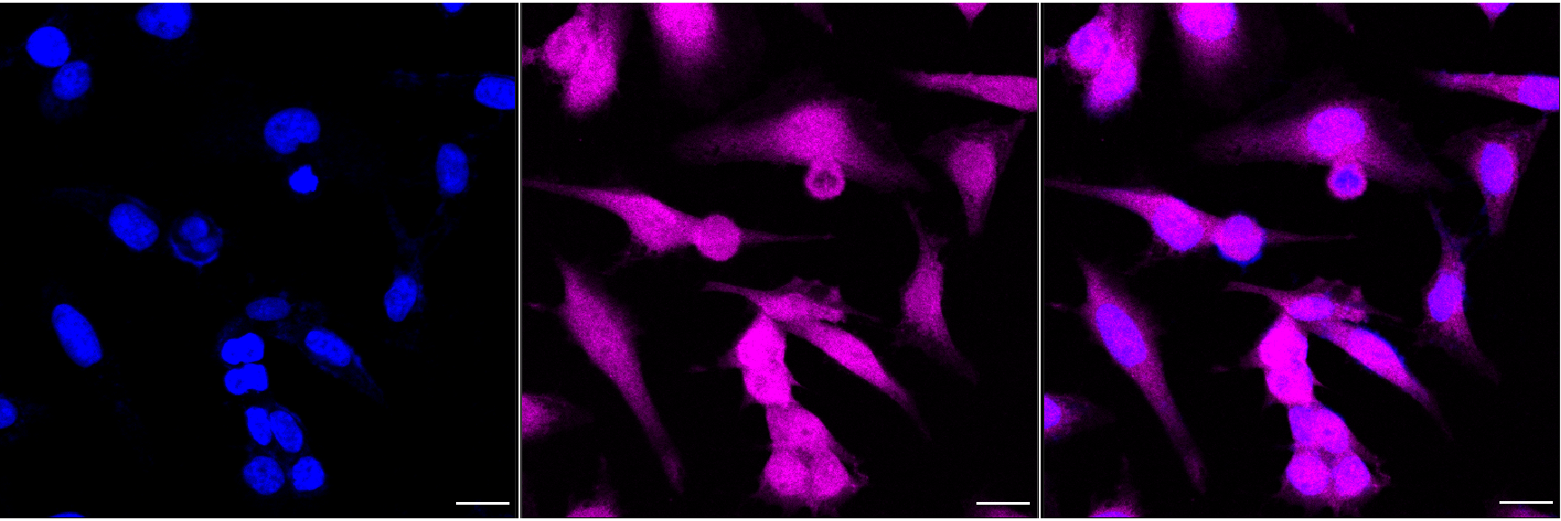 [KD Validated] Anti-CDKN2A Rabbit mAb [78G80F86]