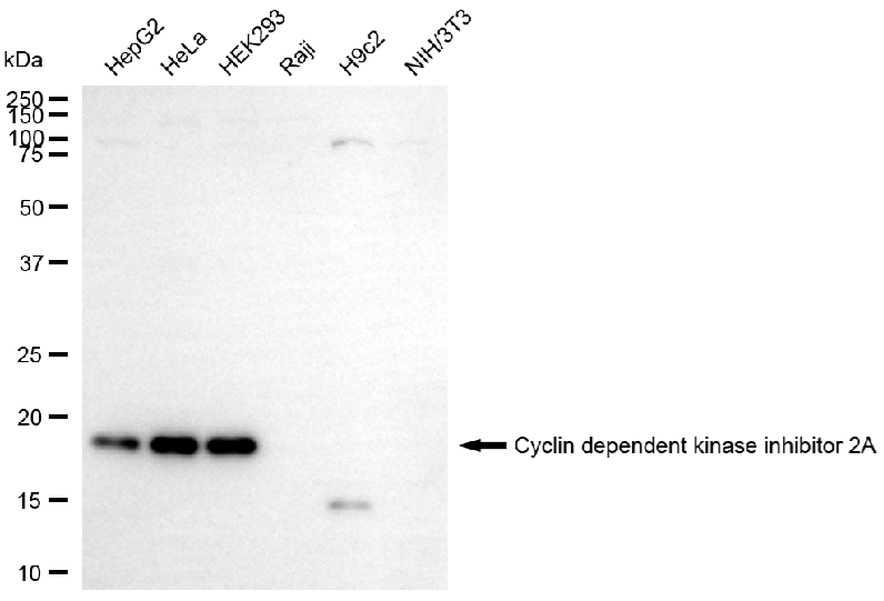 [KD Validated] Anti-CDKN2A Rabbit mAb [78G80F86]