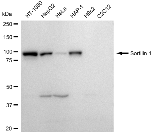 [KD Validated] Anti-SORT1 Rabbit mAb [23Q70G51]