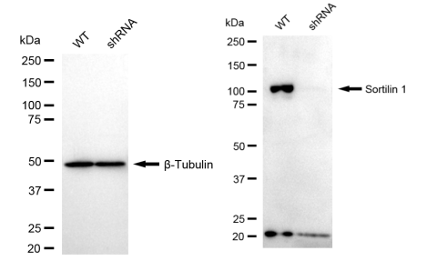 [KD Validated] Anti-SORT1 Rabbit mAb [23Q70G51]