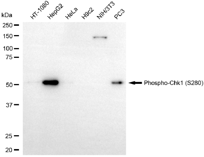[KD Validated] Anti-Phospho-Chk1 (Ser280) Rabbit mAb [80J65H83]