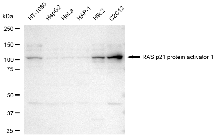 [KD Validated] Anti-RASA1 Rabbit mAb [68A51S79]