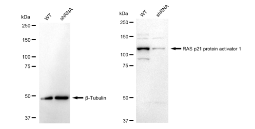 [KD Validated] Anti-RASA1 Rabbit mAb [68A51S79]
