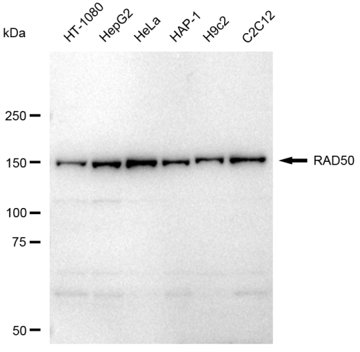 [KD Validated] Anti-RAD50 Rabbit mAb [76T27G62]