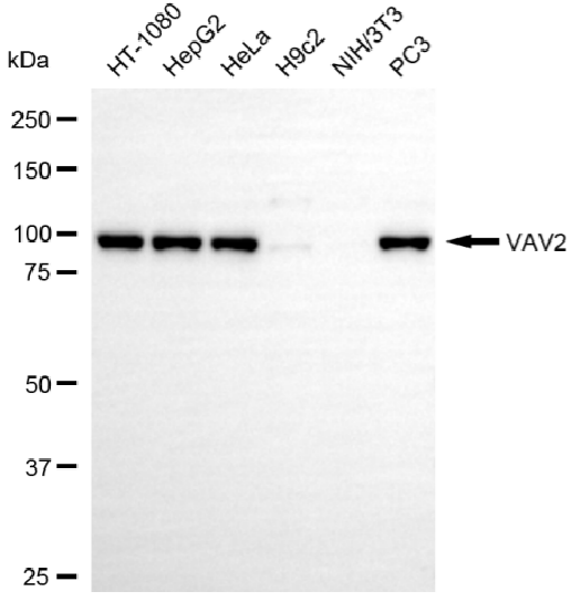 [KD Validated] Anti-VAV2 Rabbit mAb [14G78S30]