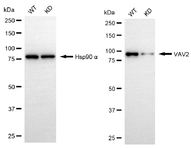 [KD Validated] Anti-VAV2 Rabbit mAb [14G78S30]