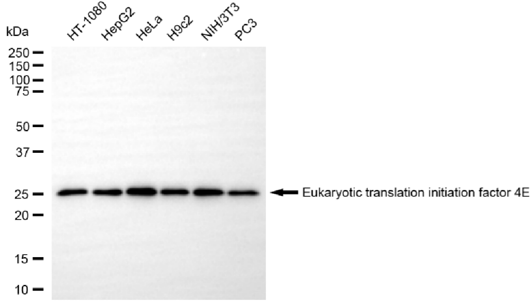 [KD Validated] Anti-EIF4E Rabbit mAb [37S02A12]