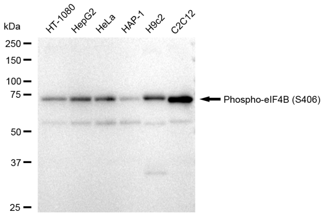 [KD Validated] Anti-eIF4B Rabbit mAb [22S68K63]