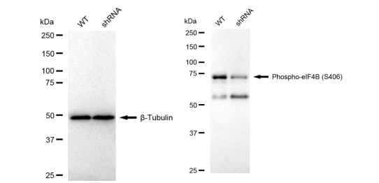 [KD Validated] Anti-eIF4B Rabbit mAb [22S68K63]