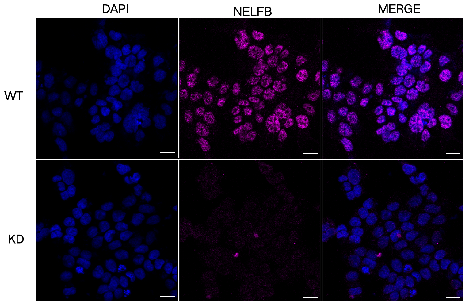 [KD Validated] Anti-NELFB Rabbit mAb [66Q79L79]