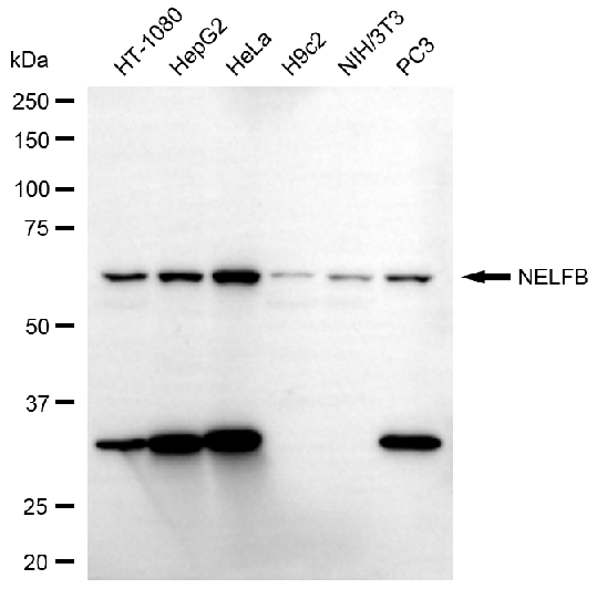 [KD Validated] Anti-NELFB Rabbit mAb [66Q79L79]