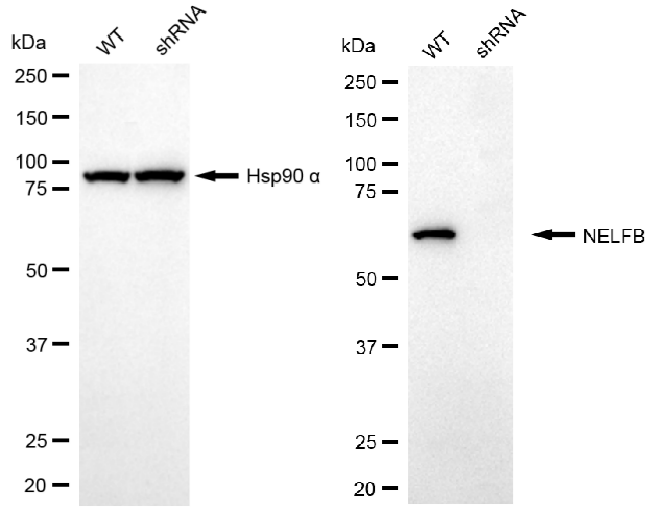 [KD Validated] Anti-NELFB Rabbit mAb [66Q79L79]