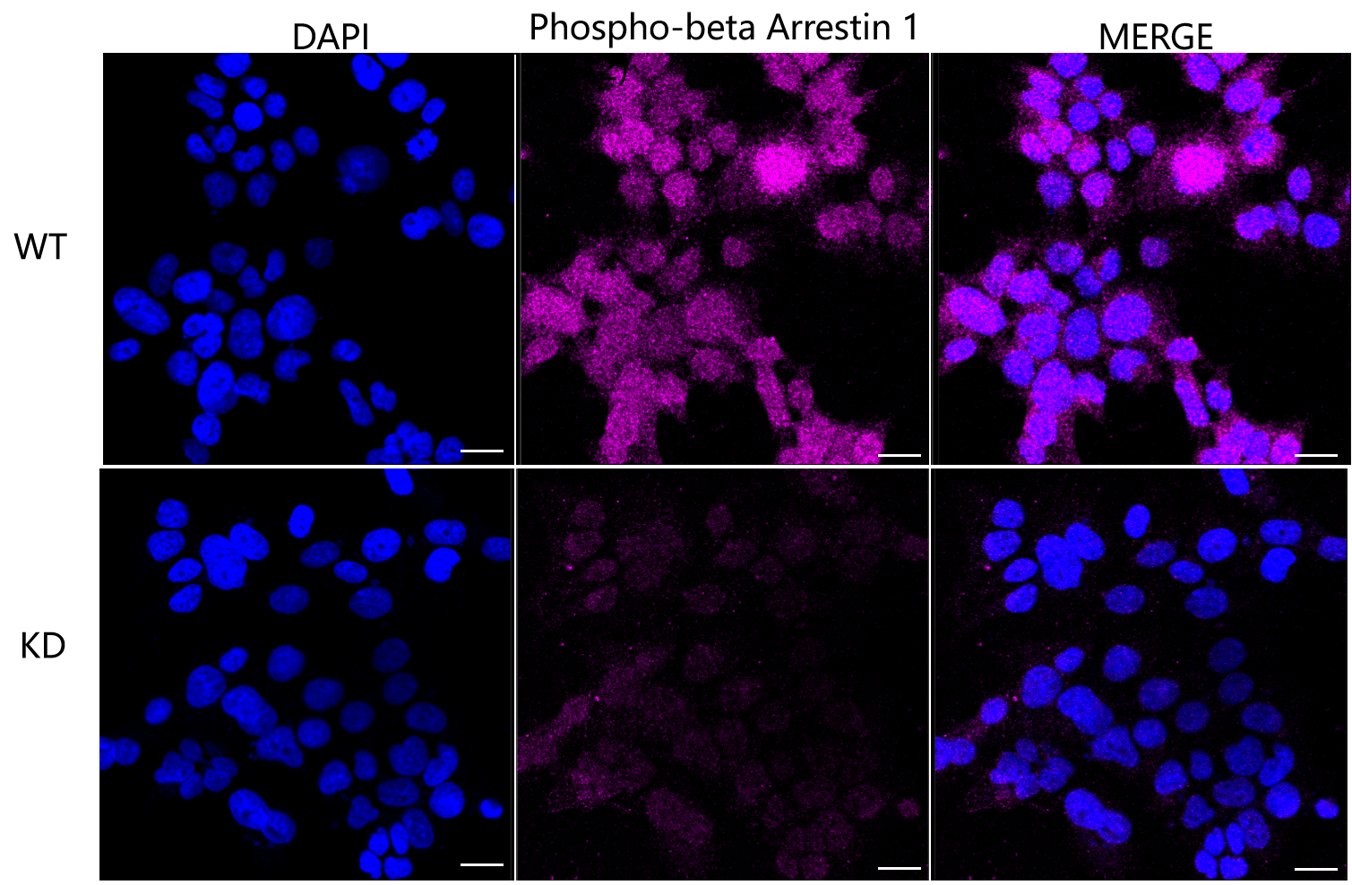 [KD Validated] Anti-ARRB1 Rabbit mAb [68E83A40]