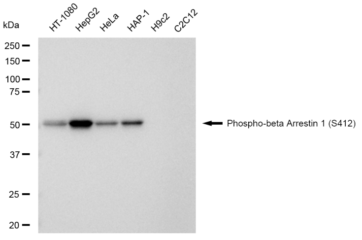 [KD Validated] Anti-ARRB1 Rabbit mAb [68E83A40]