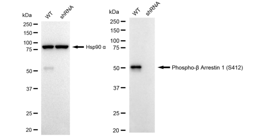 [KD Validated] Anti-ARRB1 Rabbit mAb [68E83A40]