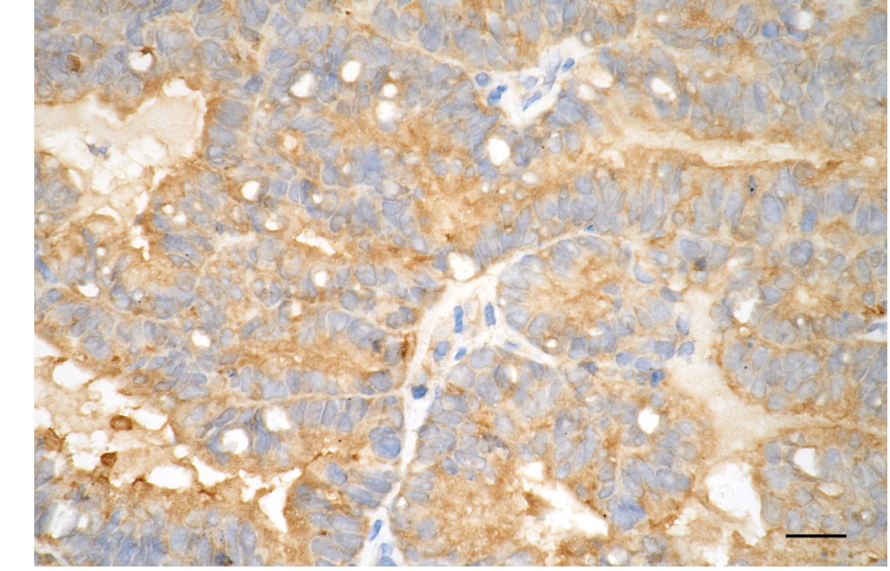 [KD Validated] Anti-GPX4 Rabbit mAb [52Q47S85]