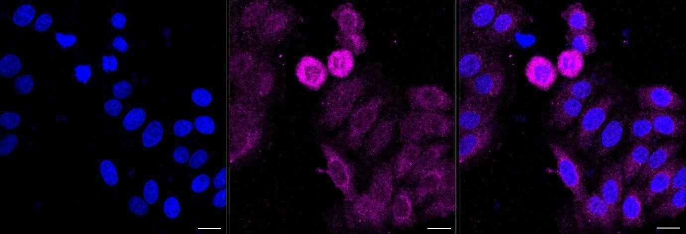 [KD Validated] Anti-CLTC Rabbit mAb [95H83O49]