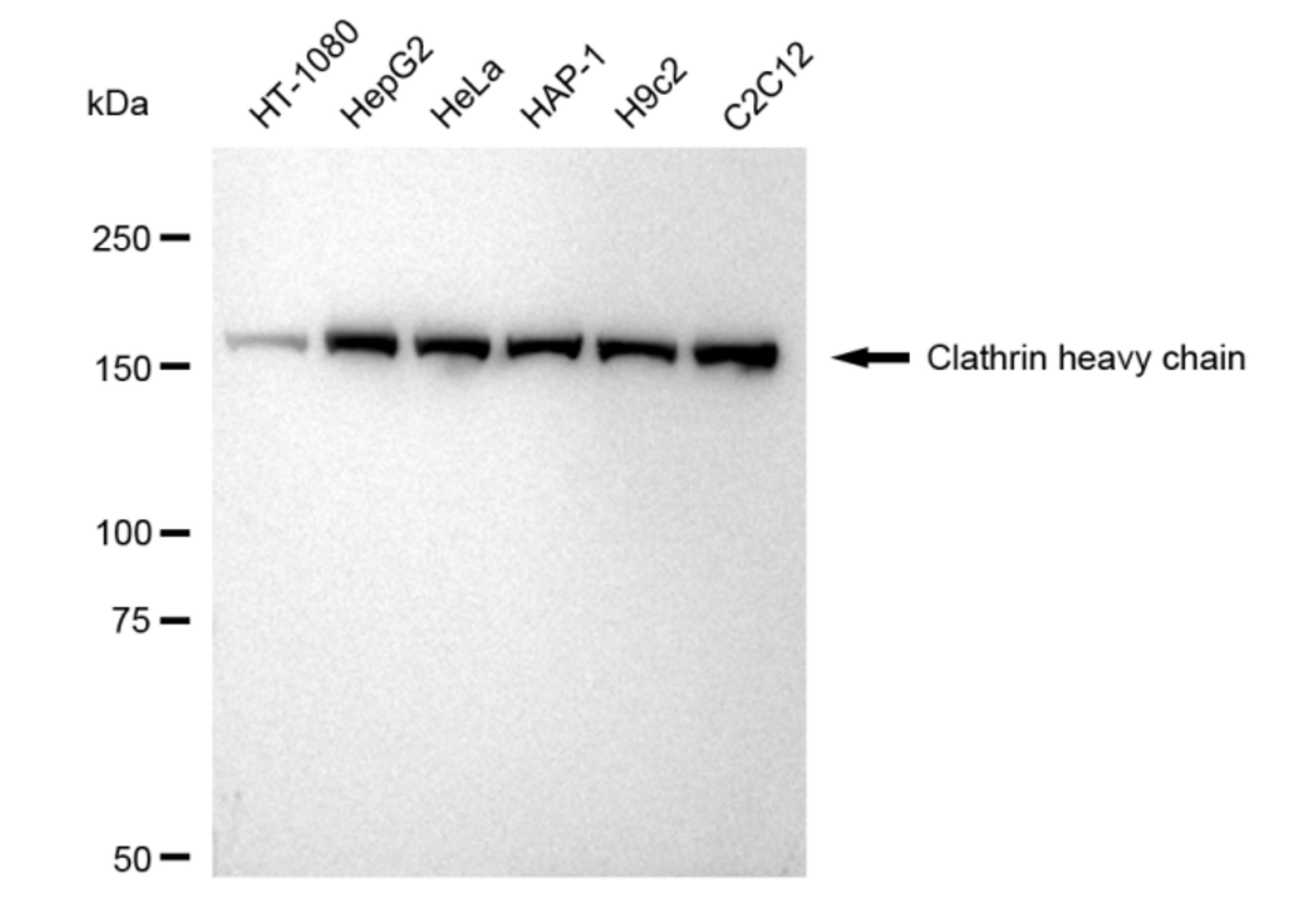 [KD Validated] Anti-CLTC Rabbit mAb [95H83O49]
