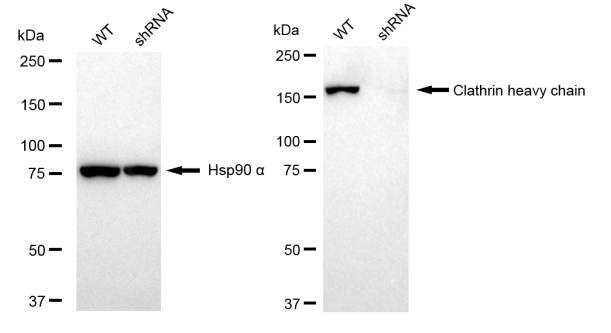 [KD Validated] Anti-CLTC Rabbit mAb [95H83O49]
