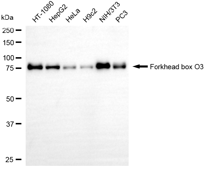 [KD Validated] Anti-FOXO3 Rabbit mAb [90G89O89]