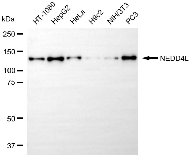 [KD Validated] Anti-NEDD4L Rabbit mAb [81E53Q95]