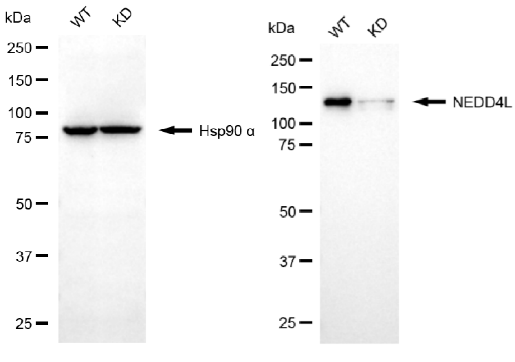 [KD Validated] Anti-NEDD4L Rabbit mAb [81E53Q95]