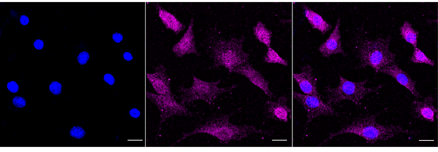 [KD Validated] Anti-ILK Rabbit mAb [29B66G58]