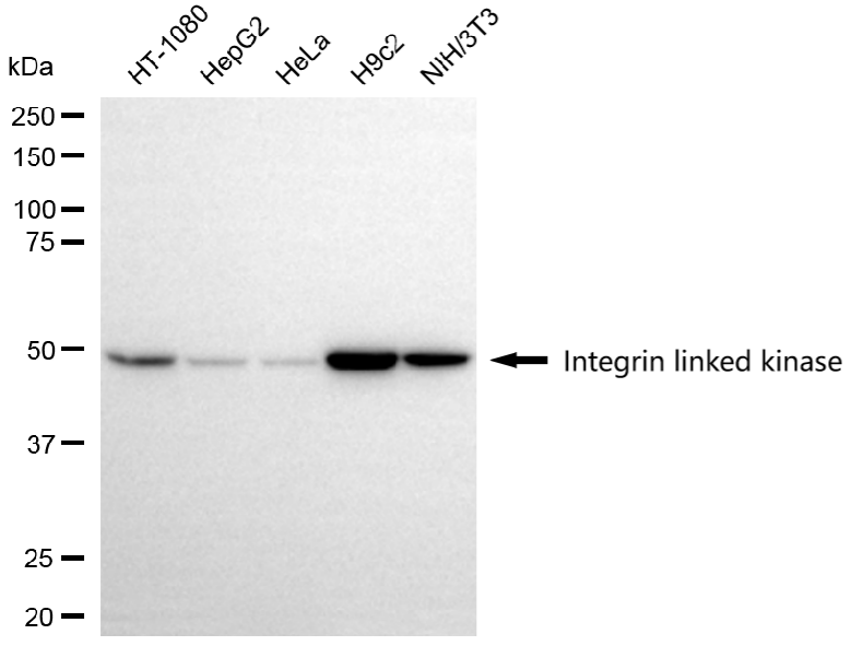 [KD Validated] Anti-ILK Rabbit mAb [29B66G58]