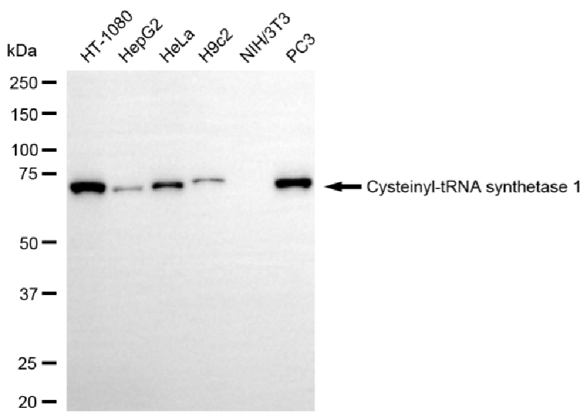 [KD Validated] Anti-CARS1 Rabbit mAb [45R82N61]