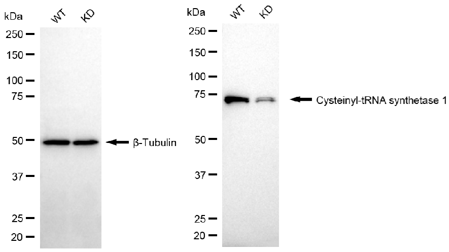 [KD Validated] Anti-CARS1 Rabbit mAb [45R82N61]