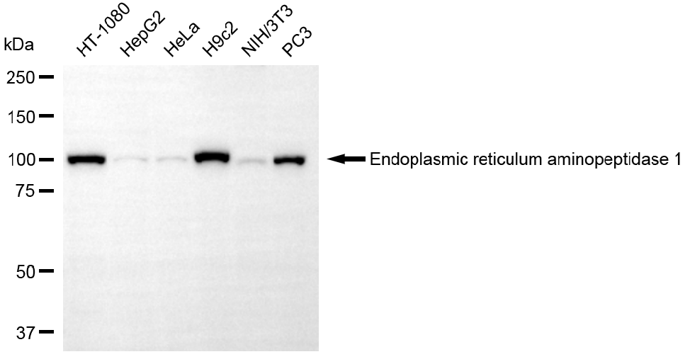 [KD Validated] Anti-ERAP1 Rabbit mAb [85E72P54]