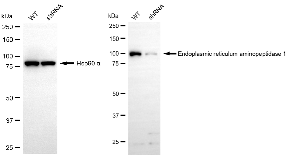 [KD Validated] Anti-ERAP1 Rabbit mAb [85E72P54]