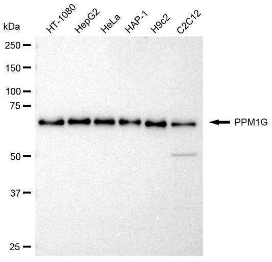 [KD Validated] Anti-PPM1G Rabbit mAb [35N56Q21]