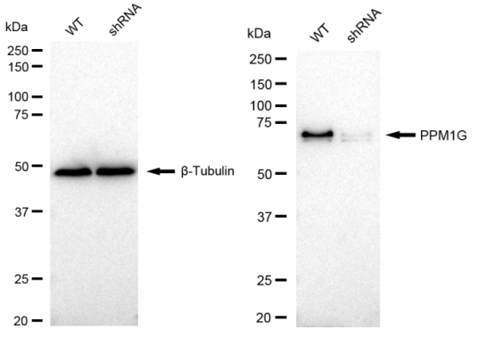 [KD Validated] Anti-PPM1G Rabbit mAb [35N56Q21]