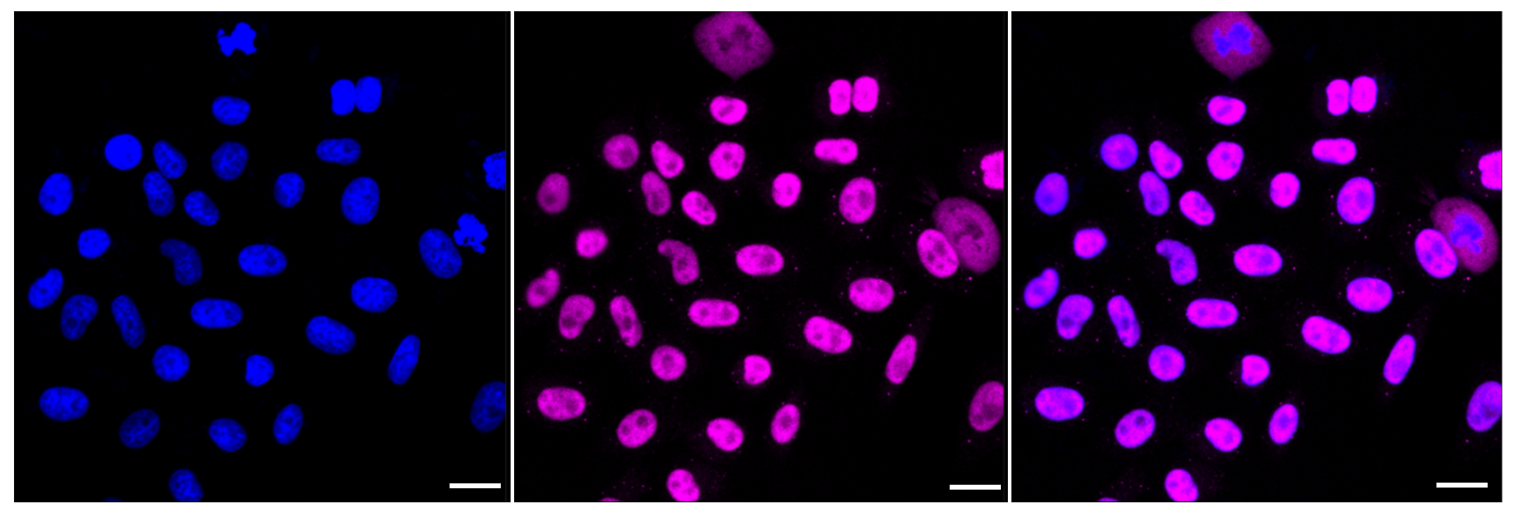 [KD Validated] Anti-PPM1G Rabbit mAb [21H74N81]