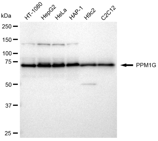 [KD Validated] Anti-PPM1G Rabbit mAb [21H74N81]