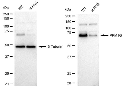 [KD Validated] Anti-PPM1G Rabbit mAb [21H74N81]