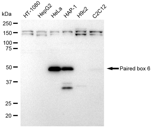 [KD Validated] Anti-PAX6 Rabbit mAb [54S94L66]