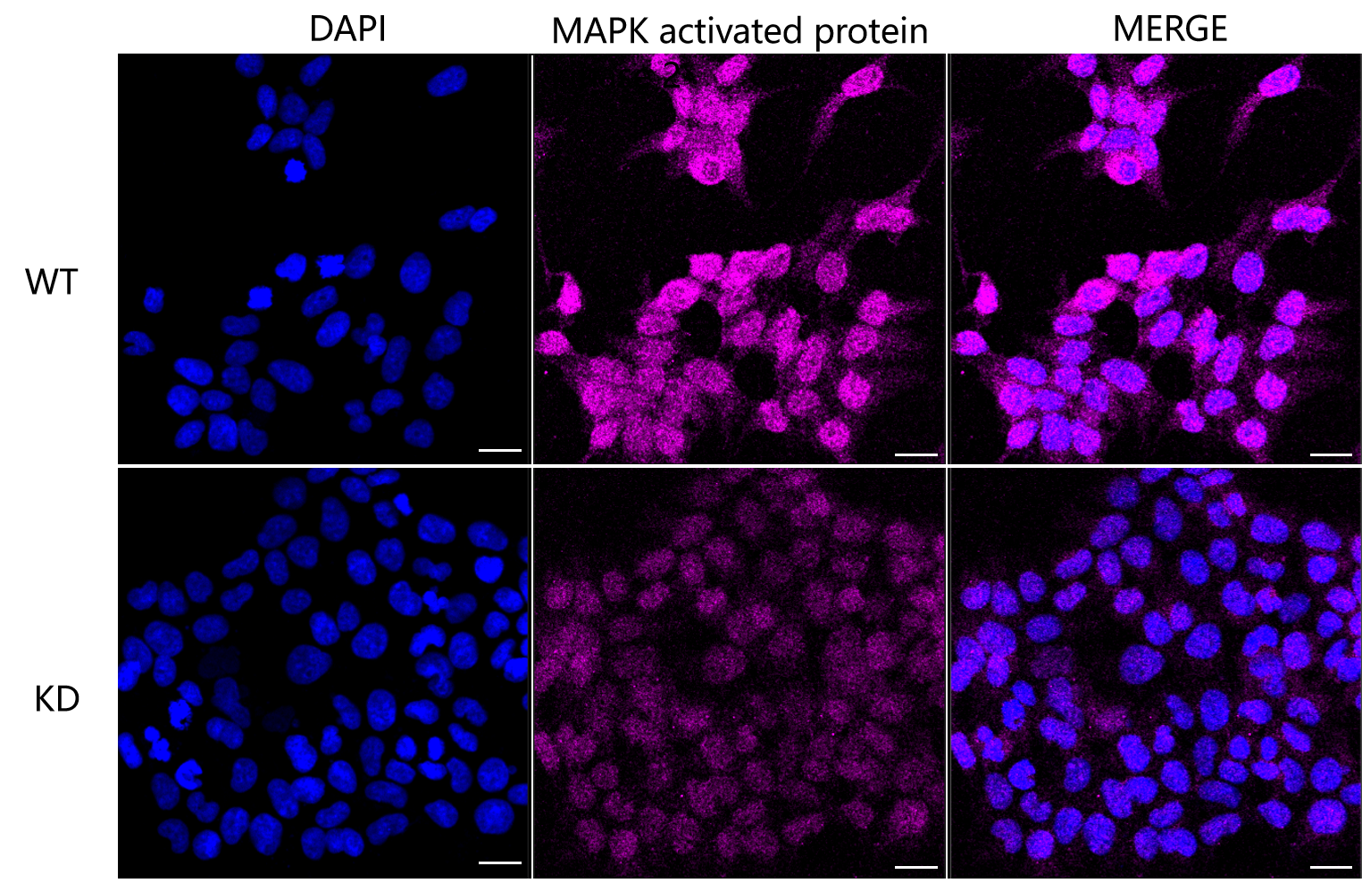 [KD Validated] Anti-MAPKAPK2 Rabbit mAb [98F76O46]