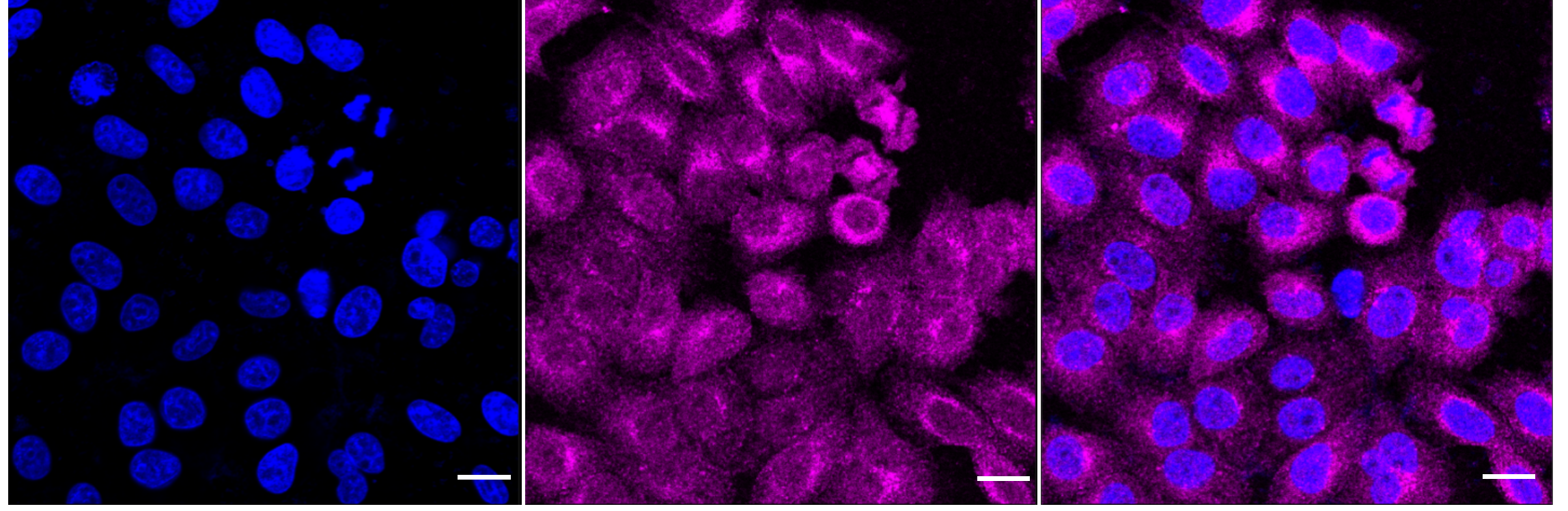 [KD Validated] Anti-MAPK3 Rabbit mAb [46S06G39]