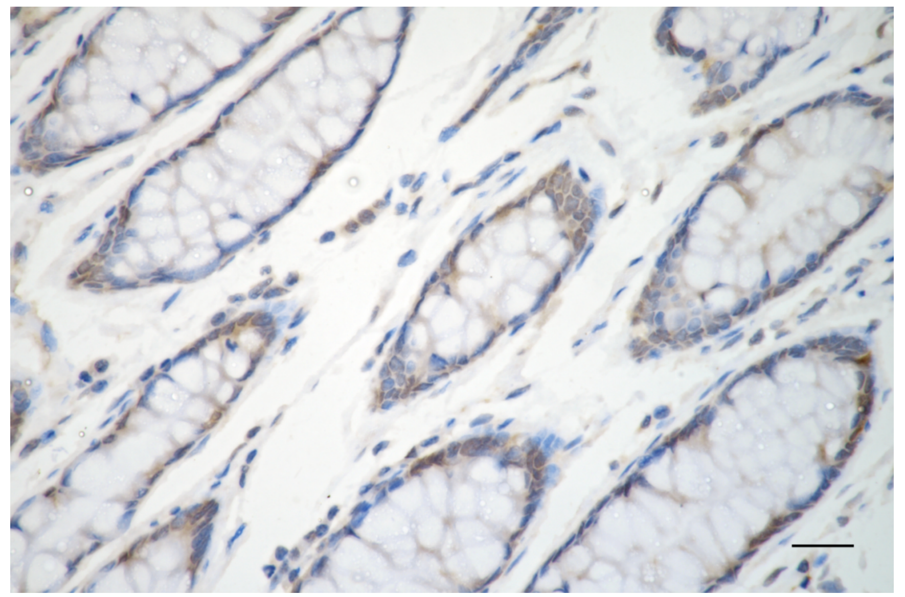 [KD Validated] Anti-MAPK3 Rabbit mAb [46S06G39]