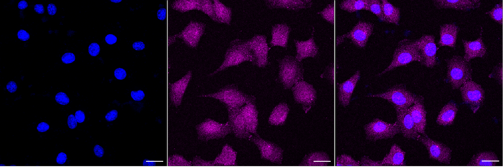 [KD Validated] Anti-RPS6KB1 Rabbit mAb [50H98F32]