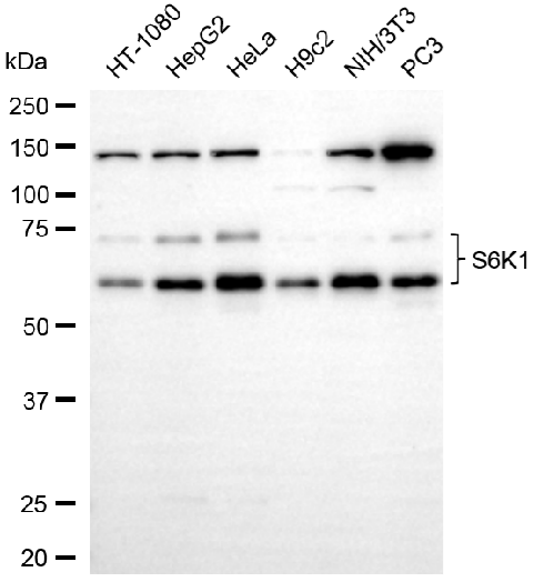 [KD Validated] Anti-RPS6KB1 Rabbit mAb [50H98F32]