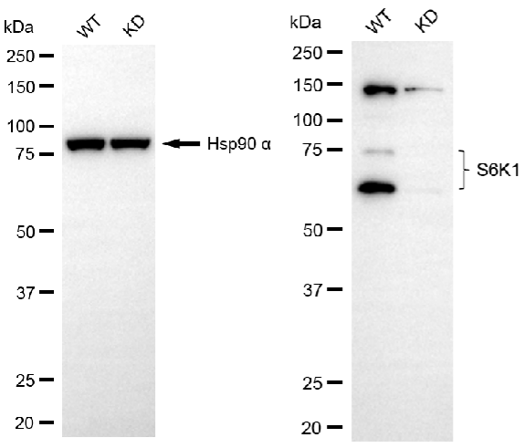[KD Validated] Anti-RPS6KB1 Rabbit mAb [50H98F32]