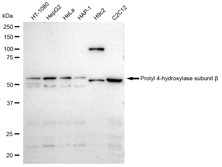 [KD Validated] Anti-P4HB Rabbit mAb [30E06R03]