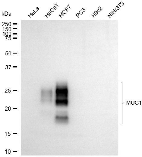 [KD Validated] Anti-MUC1 Rabbit mAb [87D54R49]