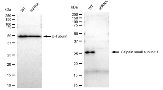 [KD Validated] Anti-CAPNS1 Rabbit mAb [93J01P44]